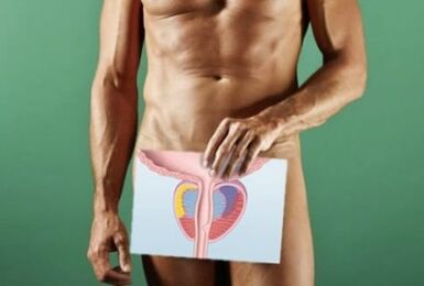 Veränderungen der Prostata bei Prostatitis